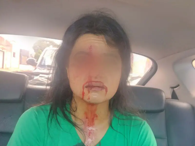 Fala Matao - VÍDEO - Mulher é agredida e leva 9 pontos após discussão de trânsito