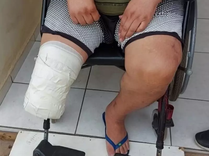 Fala Matao - Mototaxista de Matão pede ajuda após perder parte da perna em acidente