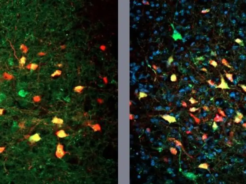 Fala Matao - Pesquisadores descobrem neurônios que levam à alimentação compulsiva mesmo sem fome